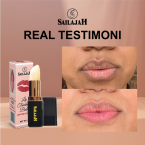  Lip Treatment Balm
