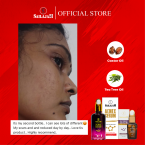  Acnex Serum ( 40 ML )