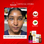  Acnex Serum ( 40 ML )