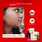  Acnex Serum ( 40 ML )
