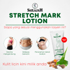 Stretch Mark Lotion