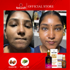 Acnex Serum 