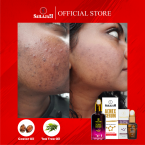 Acnex Serum 