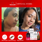 Brightening + Acne Set  