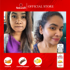Trial Acne set