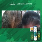 HAIRCARE SET ( ANTI HAIRFALL SET & ANTI DANDRUFF SET ) 