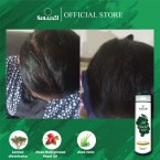 Anti Hairfall Shampoo 