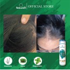  Dandruff Control Shampoo