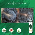 Anti Hairfall Shampoo 