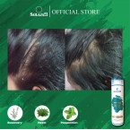  Dandruff Control Shampoo